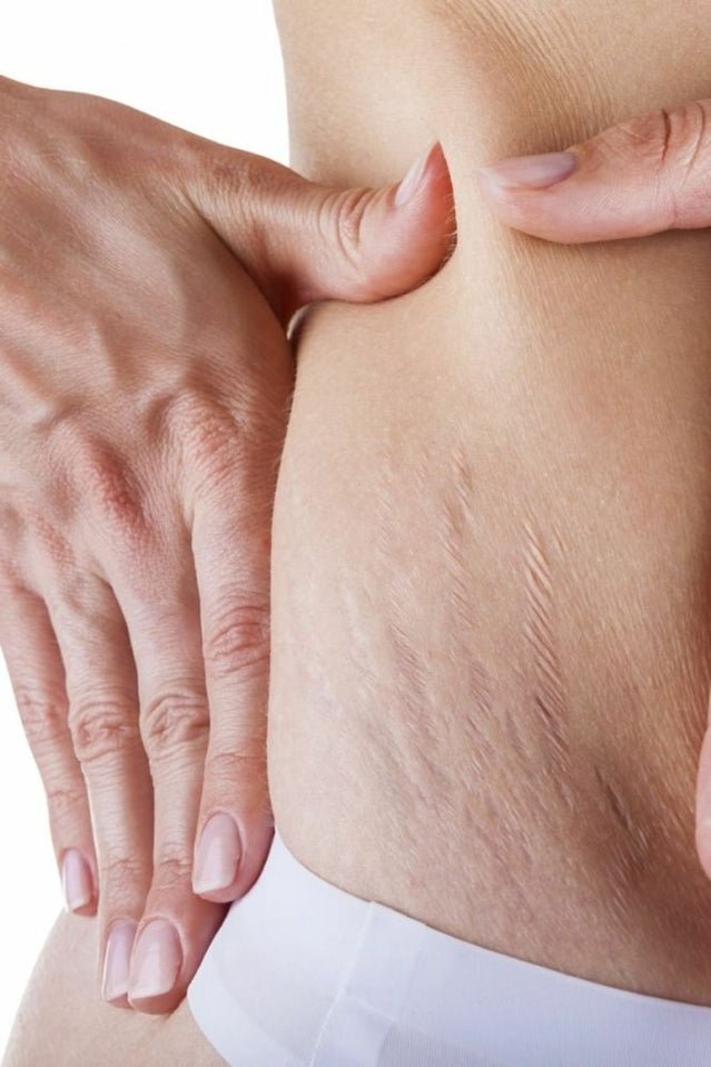 How to lose your belly fat after birth - Sahra.Nko